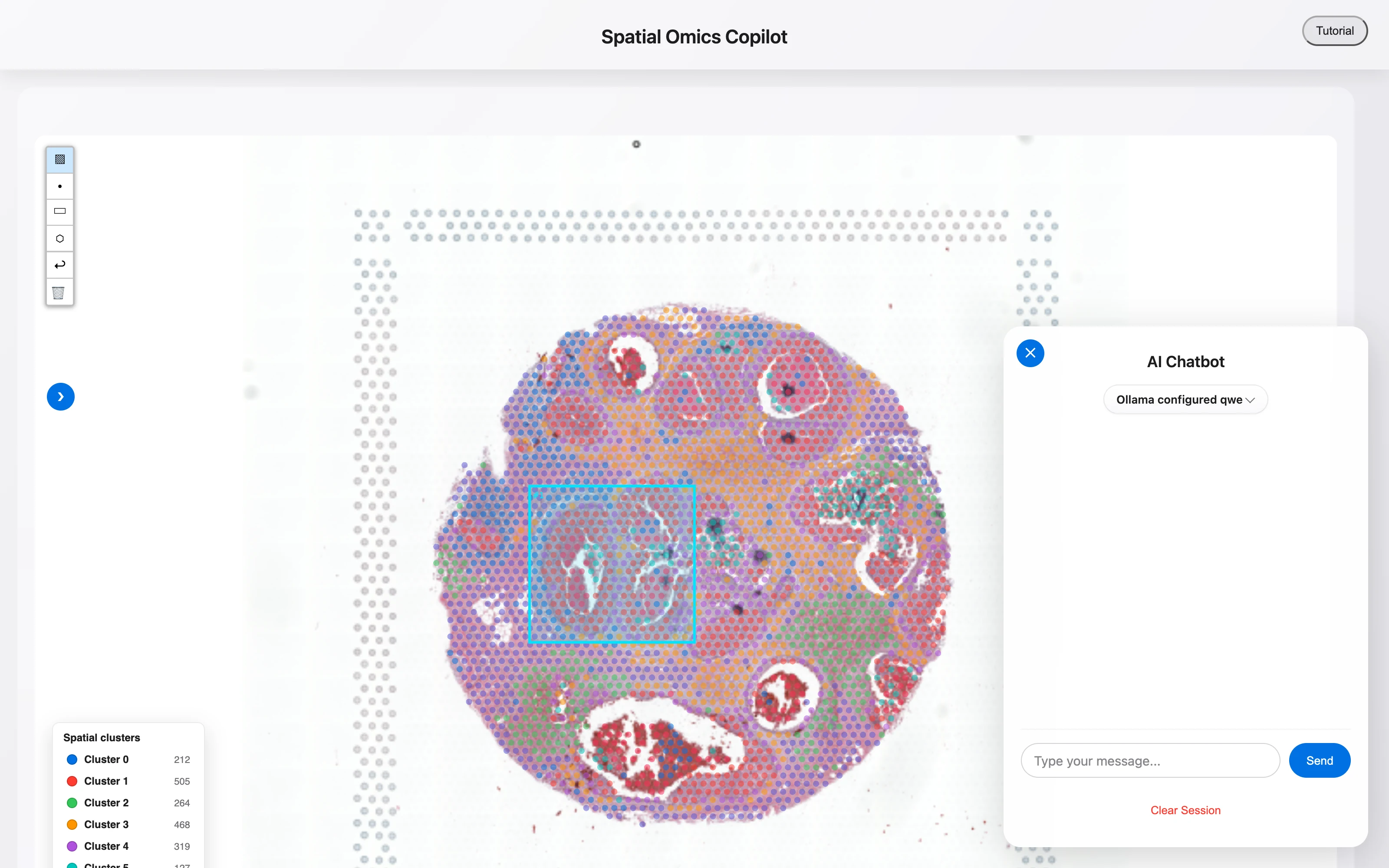 Spatial Omics Copilot: The job
